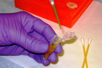A researcher handling samples in a medical laboratory