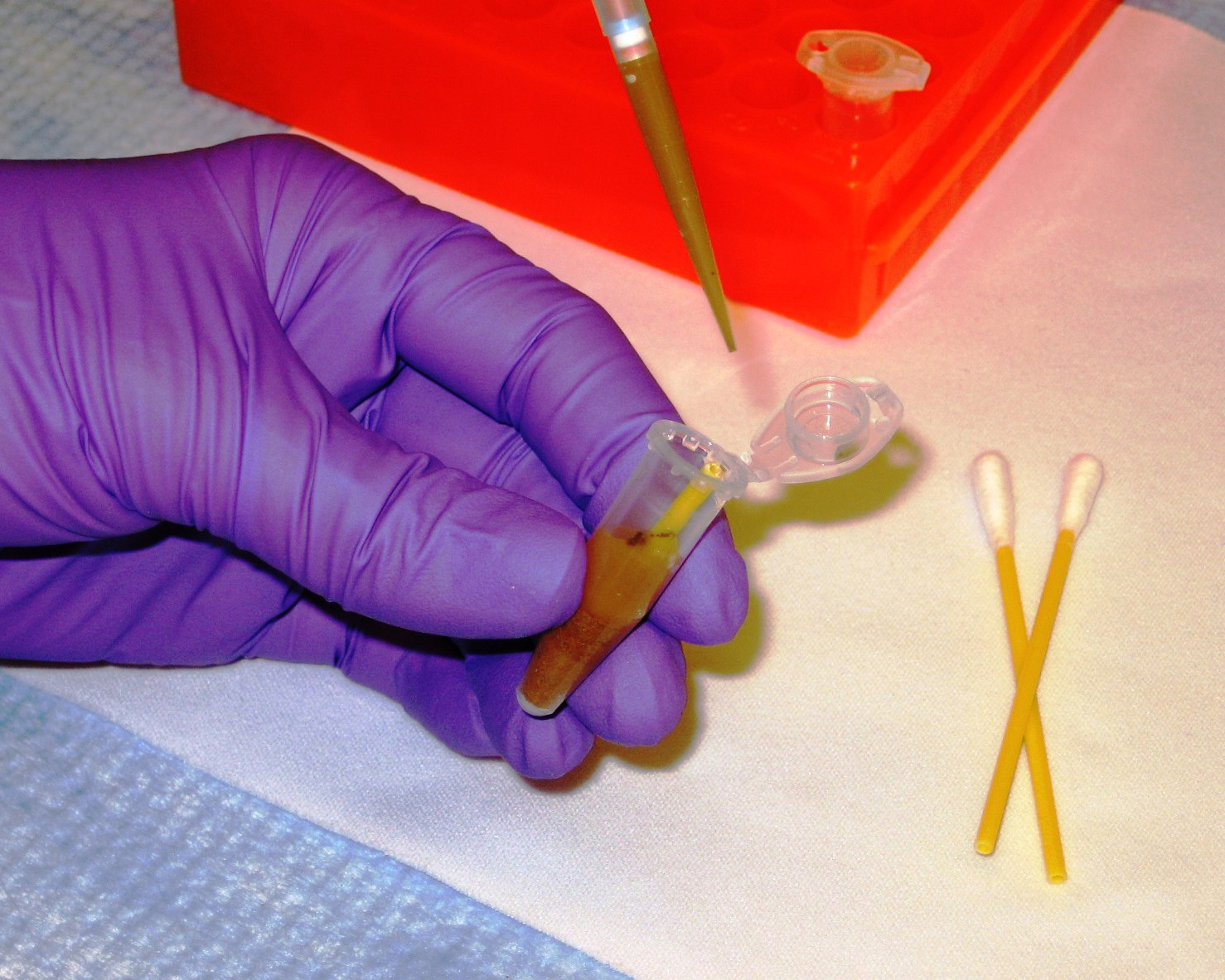 A researcher handling samples in a medical laboratory